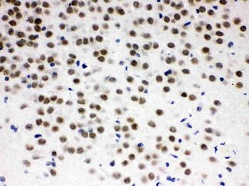 Anti-ZBTB7A Antibody