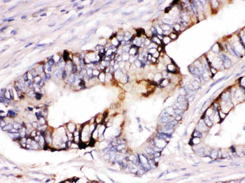 Anti-ZP2 Antibody