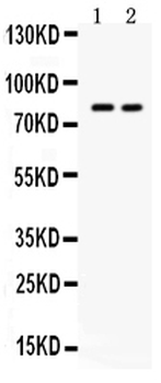 Anti-ZP2 Antibody