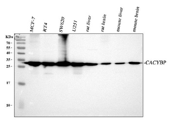 SIAH Interacting Protein/CACYBP Antibody