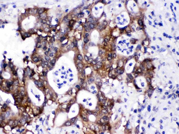 Anti-SIAH Interacting Protein/CACYBP Antibody