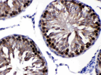 Anti-SIAH Interacting Protein/CACYBP Antibody