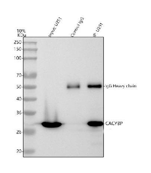 Anti-SIAH Interacting Protein/CACYBP Antibody