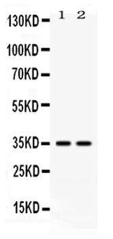 LFA3/CD58 Antibody