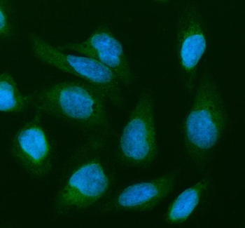 Anti-Cofilin 2/CFL2 Antibody