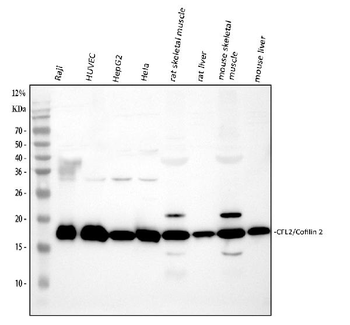Anti-Cofilin 2/CFL2 Antibody