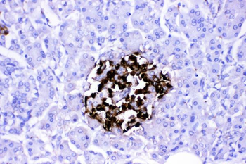 Anti-VIP peptides VIP Antibody