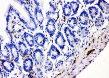 Anti-VIP peptides VIP Antibody