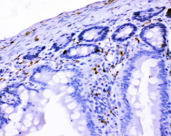 Anti-VIP peptides VIP Antibody