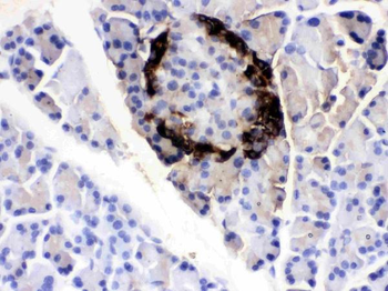 Anti-VIP peptides VIP Antibody