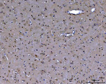 Anti-ABL2 Antibody