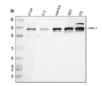 Anti-ABL2 Antibody