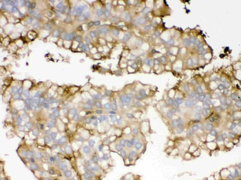 Anti-Apolipoprotein A I/APOA1 Antibody