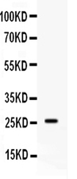 Anti-Apolipoprotein A I/APOA1 Antibody