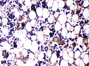 Anti-Osteocalcin/BGLAP Antibody