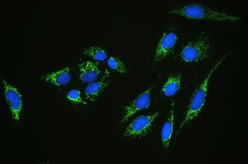 GC1q R/C1QBP Antibody