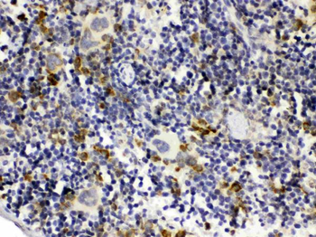 Anti-GC1q R/C1QBP Antibody