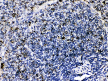 Anti-GC1q R/C1QBP Antibody