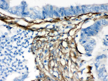 Anti-Caldesmon/CALD1 Antibody
