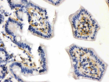 Anti-Caldesmon/CALD1 Antibody