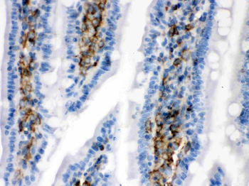 Anti-Caldesmon/CALD1 Antibody
