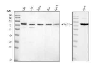 Anti-Caldesmon/CALD1 Antibody
