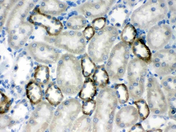 Anti-Calcium Sensing Receptor/CASR Antibody