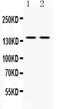 Anti-Calcium Sensing Receptor/CASR Antibody