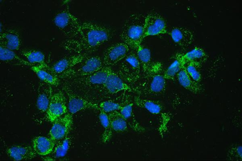 Anti-Catalase Antibody
