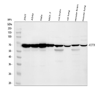 Anti-CCT3 Antibody