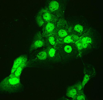 Anti-CCT3 Antibody