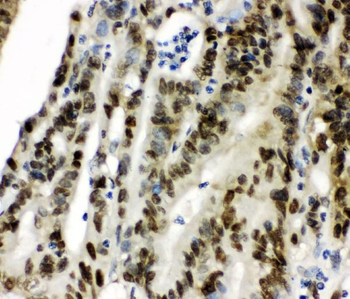 Anti-CCT3 Antibody