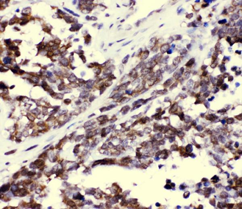 Anti-CCT3 Antibody
