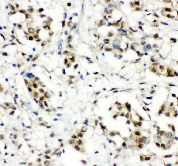 Anti-CCT3 Antibody