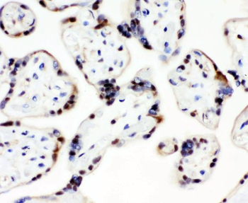 Anti-CCT3 Antibody