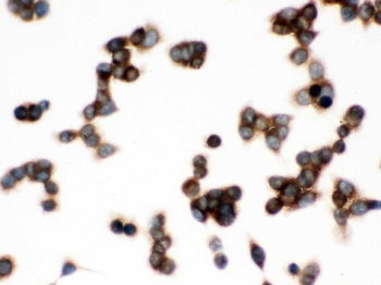 Anti-TCP1 delta/CCT4 Antibody