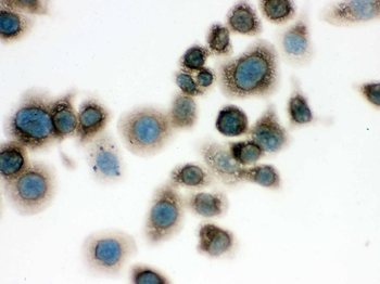 Anti-TCP1 delta/CCT4 Antibody