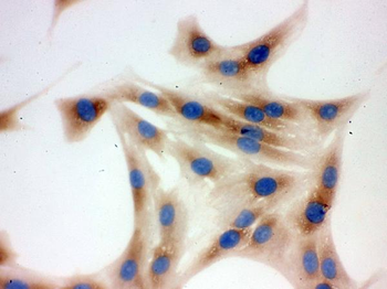 Anti-TCP1 delta/CCT4 Antibody