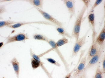 Anti-TCP1 delta/CCT4 Antibody