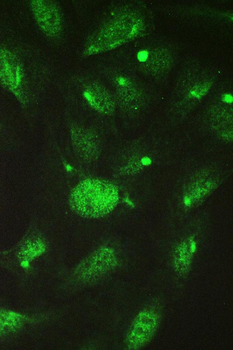 Anti-TCP1 delta/CCT4 Antibody