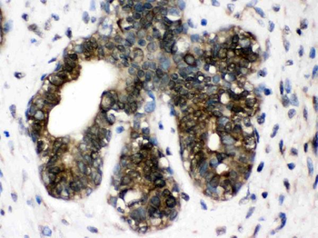 Anti-TCP1 delta/CCT4 Antibody