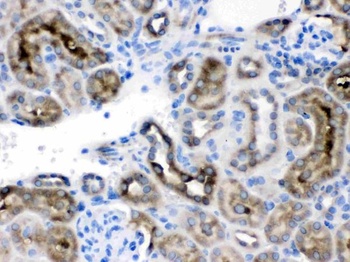 TCP1 delta/CCT4 Antibody