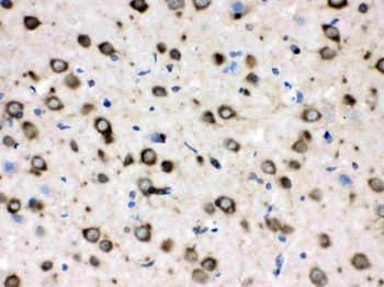 Anti-TCP1 delta/CCT4 Antibody