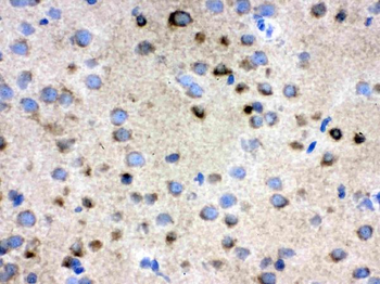 Anti-TCP1 delta/CCT4 Antibody