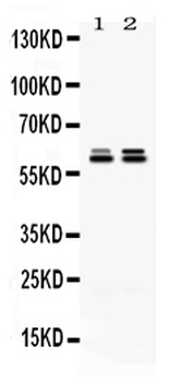 TCP1 epsilon/CCT5 Antibody