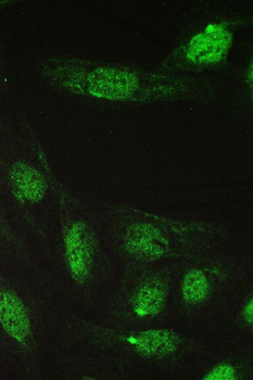 Anti-TCP1 epsilon/CCT5 Antibody