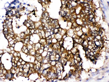 Anti-TCP1 epsilon/CCT5 Antibody