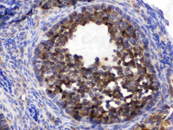 Anti-TCP1 epsilon/CCT5 Antibody