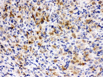 Anti-TCP1 epsilon/CCT5 Antibody