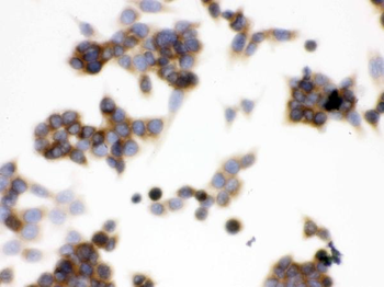 Anti-TCP1 epsilon/CCT5 Antibody